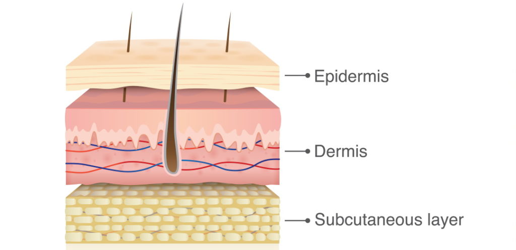 three-layers-of-skin | Cosmetic Laser Centers