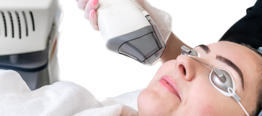 Does Fraxel® Laser Help Reduce Acne Scars?