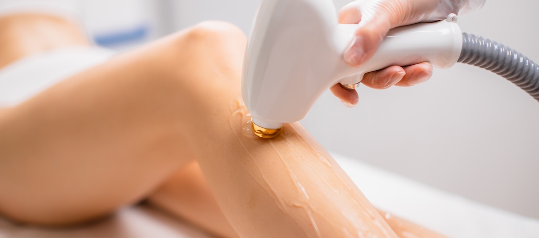 Why You Should Choose Laser Hair Removal Over Traditional Methods