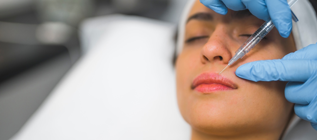 Can Dermal Fillers Migrate?